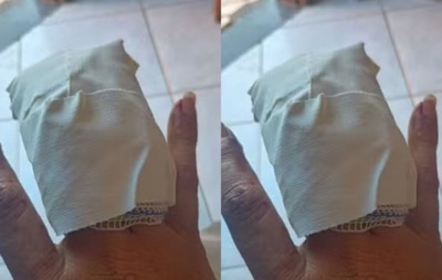 Motorista por aplicativo perde parte de dedo da mão após ter bomba de São João jogada dentro do carro