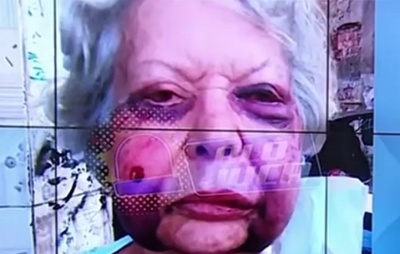 Idosa de 70 anos é espancada em assalto na Lapinha; suspeito fazia trabalhos para a vítima