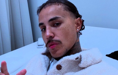MC Livinho recebe alta após acidente grave de moto e agradece por "nova chance de viver"