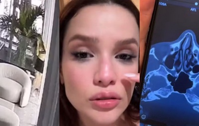 VÍDEO: Ex-BBB Juliette vai parar na emergência após acidente doméstico e descobre fratura no nariz