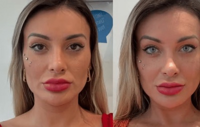 VÍDEO: Andressa Urach diz ter se arrependido de procedimento para mudar cor dos olhos