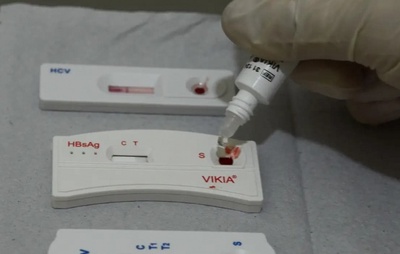 Outubro Verde: Salvador intensifica combate à sífilis com testagem e tratamento gratuito