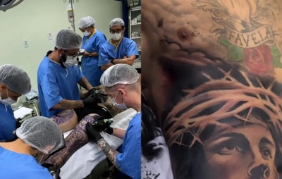 Conselho Federal de Medicina publica resolução que proíbe aplicar anestesia para fazer tatuagem