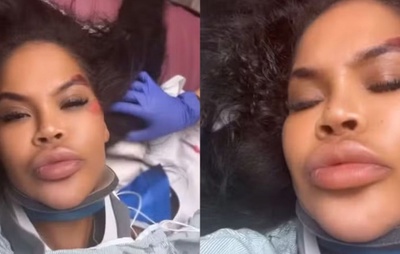 Ex-Big Brother sofre acidente de carro e cita omissão de socorro: "Deixara para morrer"