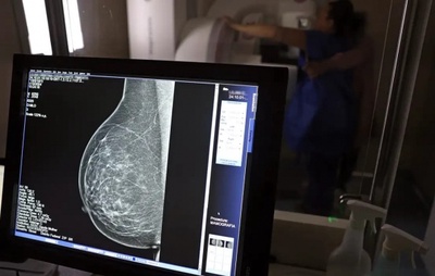 Câncer de Mama na Bahia: novos casos e mortalidade em alta, alerta a SEI