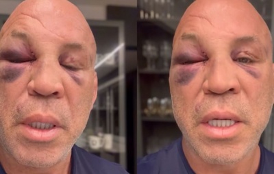 Wanderlei Silva relata dores de cabeça e lapsos de memória após confusão no Spaten Fight Night; Popó passa por cirurgia