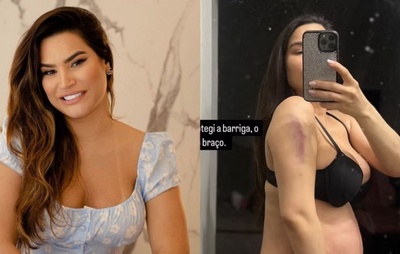 Grávida, ex-A Fazenda Raissa Barbosa vai parar em hospital após cair de escada